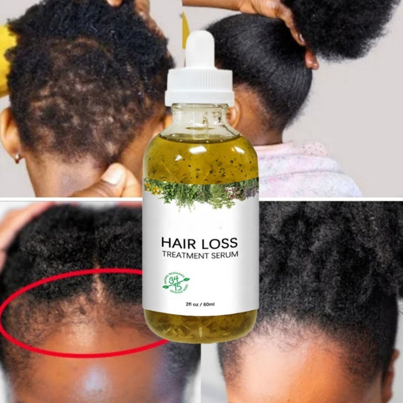 New Fast Hair Growth Serum African Crazy Regrowth Traction Alopecia Hair Loss Prevent Edges Bald Spot Thinnin Hair Treatment Oil